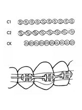 3M Unitek Alastik Bobbin Chain.