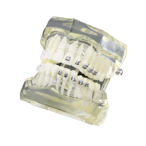 Dental Ortho Half Metal/Half Ceramic Education Model