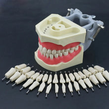 API Typodont Teeth Set with Screw Buy Dental products Online DentalMyntra