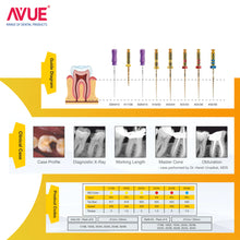 AVUE Aurum - Aurum (Gold) Heat Treated Rotary File System - Pack Of 6 Buy Dental products Online DentalMyntra