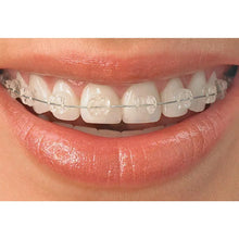 Axim Ceramic Brackets Buy Dental products Online DentalMyntra