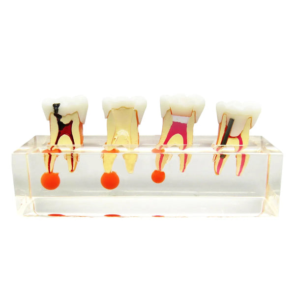 DENTical Study Model Root Canal Treatment M 4018 Buy Dental products Online DentalMyntra