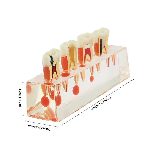 DENTical Study Model Root Canal Treatment M 4018 Buy Dental products Online DentalMyntra