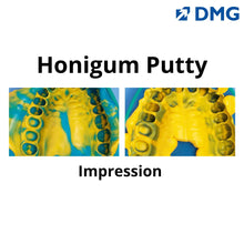 DMG Honigum - A-Silicone Impression Material Buy Dental products Online DentalMyntra