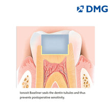 DMG Ionosit - Light Cured Baseliner Material Buy Dental products Online DentalMyntra