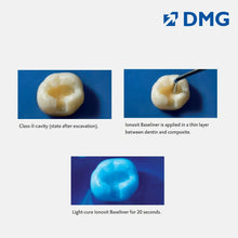 DMG Ionosit - Light Cured Baseliner Material Buy Dental products Online DentalMyntra