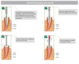 Diadent EvoFill Gutta Percha Cartridges Buy Dental products Online DentalMyntra