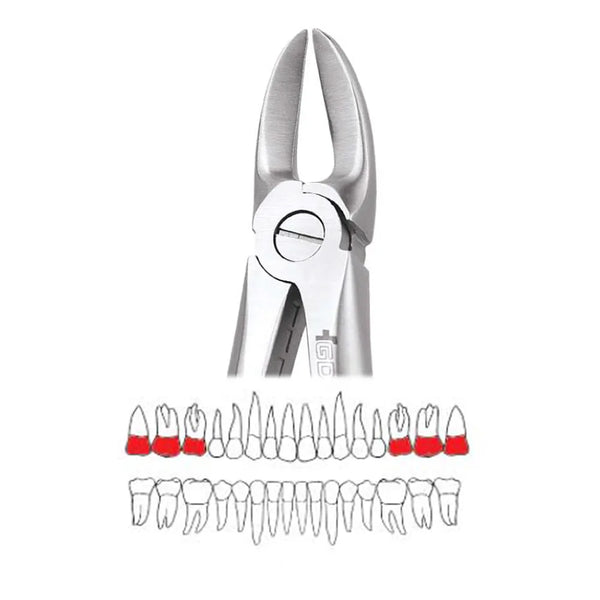 GDC Extraction Forceps Separating Upper Molars - 55 Standard (FX55S) Buy Dental products Online DentalMyntra