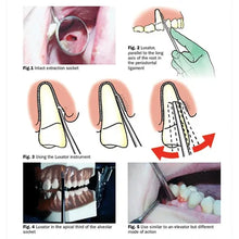 GDC Luxatip - 2mm Straight (L2s) Buy Dental products Online DentalMyntra