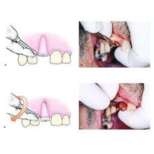 GDC Root Elevators Root Elevators for luxation of teeth Buy Dental products Online DentalMyntra