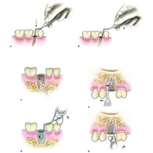 GDC Root Elevators Root Elevators for luxation of teeth Buy Dental products Online DentalMyntra