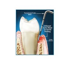 GDC Spreaders -1 (Rcsd11t Buy Dental products Online DentalMyntra