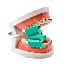 Mouth Prop with Suction Attachment Buy Dental products Online DentalMyntra