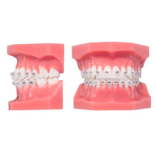 Osstem Orthodontics OK Real Resin With Metal Slot Bracket Buy Dental products Online DentalMyntra