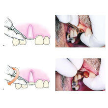 Root Elevators Apexo Standard (E301) Buy Dental products Online DentalMyntra