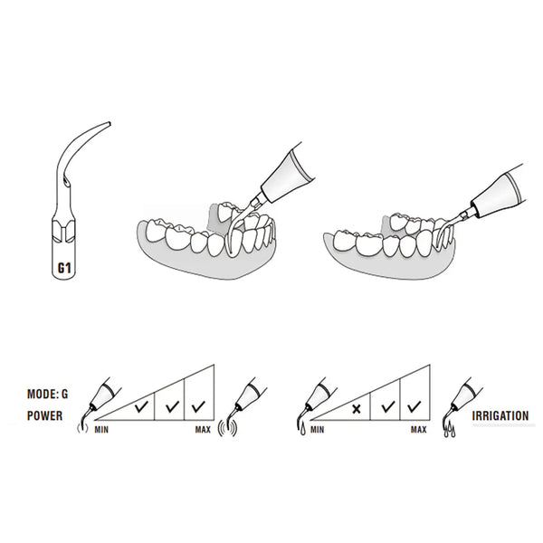 Woodpecker Scaler Tips GD1 for DTE & Satelec Scalers Buy Dental products Online DentalMyntra