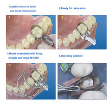 Tor Vm Contoured Metal Matrices - Molars No 1.550