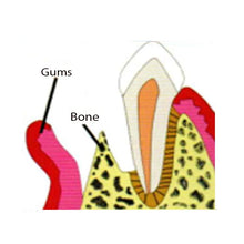 Cologenesis Colo Gide GTR Membrane Pack of 1 Pc