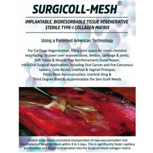 Advance Biotech Surgicoll Mesh